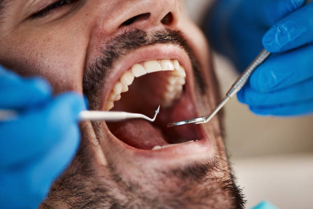 Best Emergency Dental Care for Sports Injuries in Paonia, CO